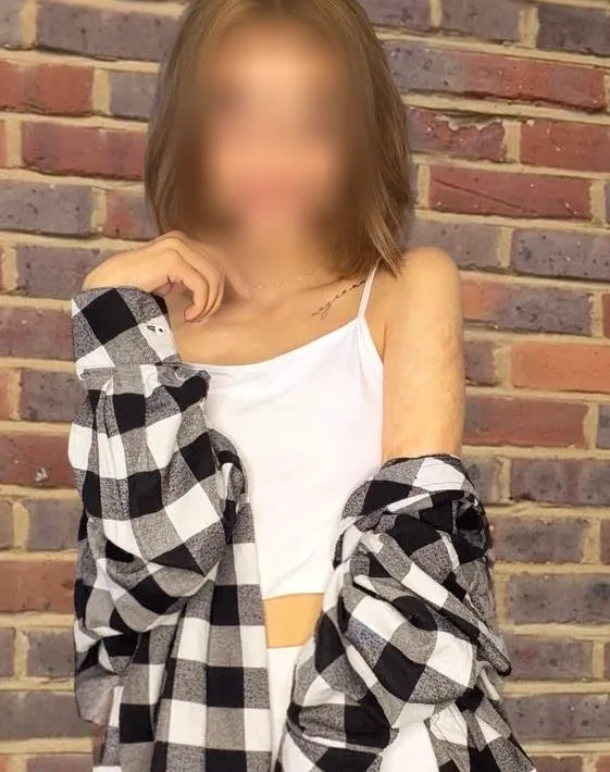 Skye, 28